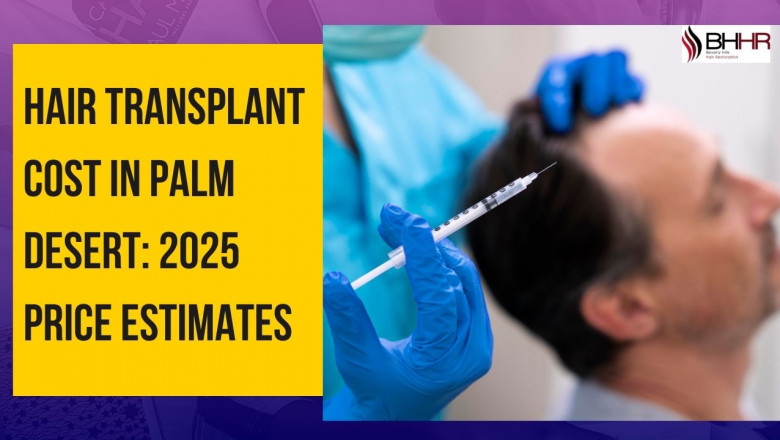Hair Transplant Cost in Palm Desert: 2025 Price Estimates