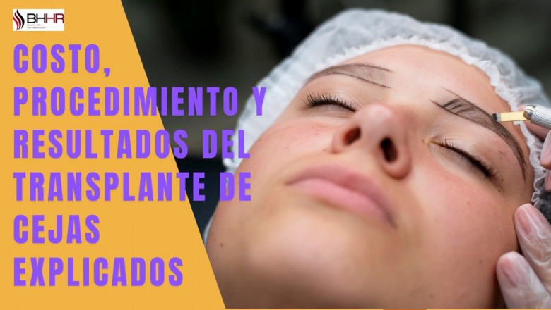 Costo, Procedimiento y Resultados del Transplante de Cejas Explicados