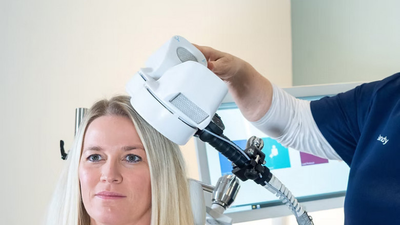 Top 5 Benefits of TMS Therapy for Depression
