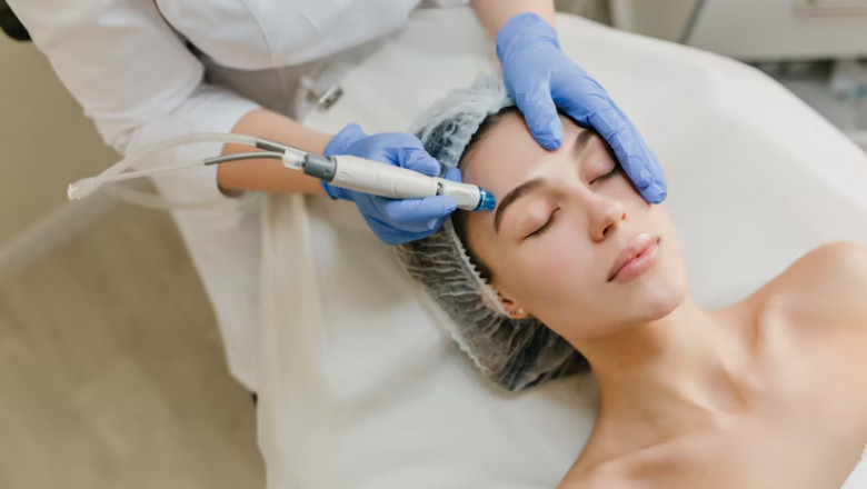 Discover the Benefits of Dermaplaning in Euless