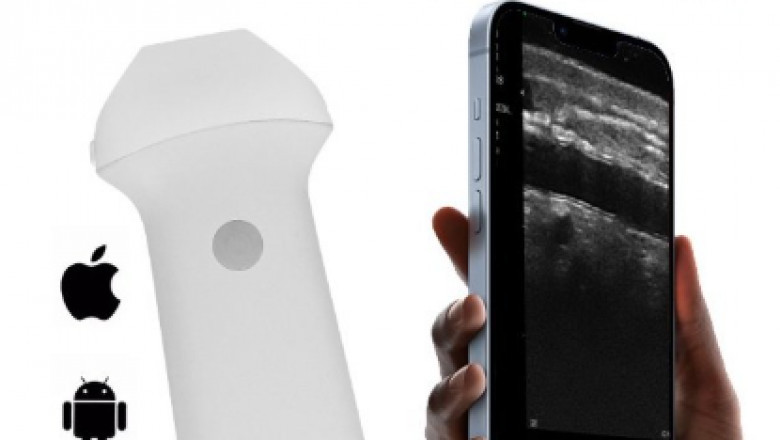 High-Frequency 16-20MHz Ultrasound for Detailed Imaging