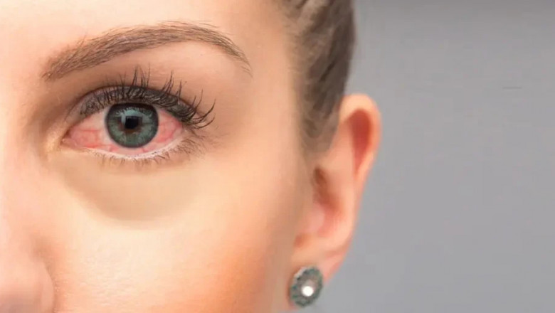Lasik and the Retina: What to Know Before Surgery