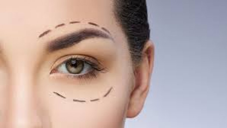 Upper Blepharoplasty in Jeddah: Say Goodbye to Droopy Eyelids Safely