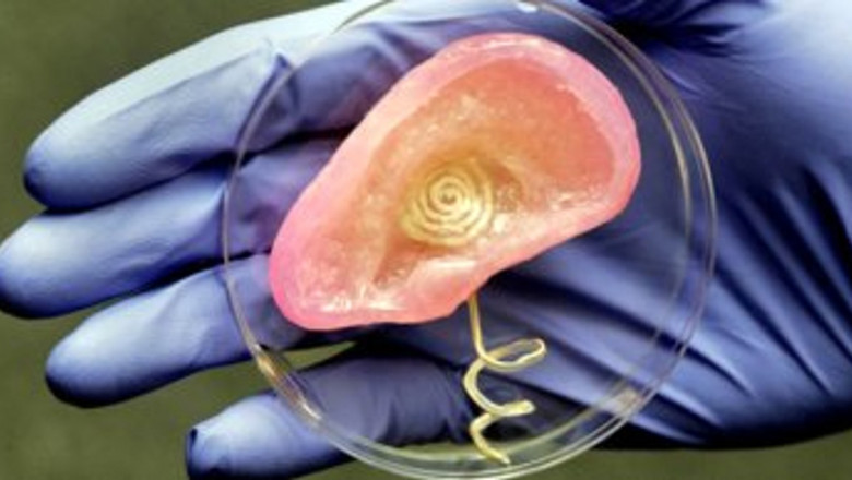Artificial Vital Organs And Medical Bionics Market Set to Soar with 3D
