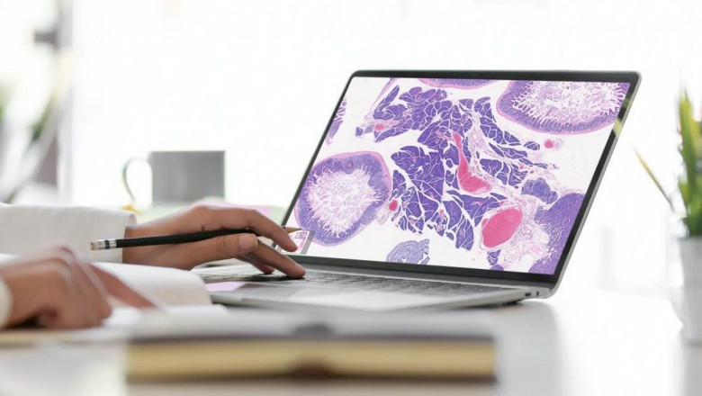 AI-based Digital Pathology Market Growth and Industry Outlook 2025-2032