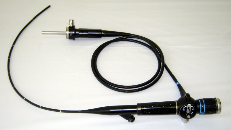 "Navigating the Ultrasound Endoscope Market: Insights &amp; Forecast (2021–2031)"