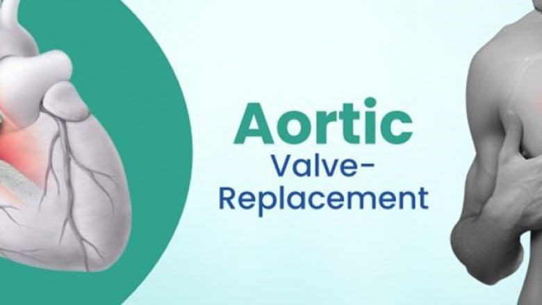 Aortic Valve Replacement Cost in India: A Complete Guide
