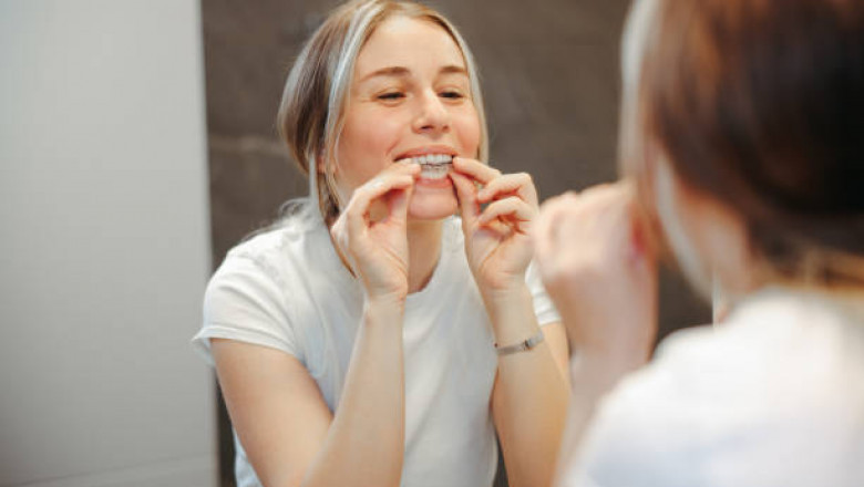 The Science Behind a Whiter Smile: Teeth Whitening Advances in Riyadh