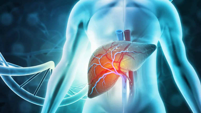 What Are the Genetic Factors That Increase Your Risk of Liver Disease?