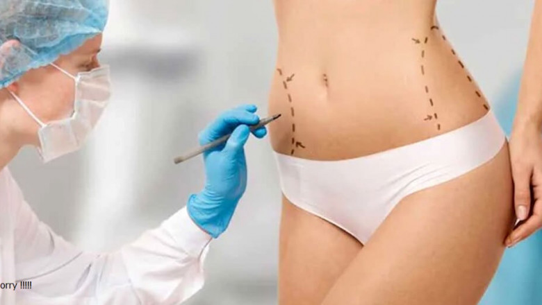 The Role of Expertise and Experience in Finding the Best Tummy Tuck Surgeon in Dubai
