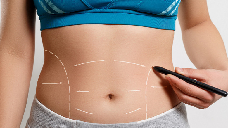 Expert Abdominoplasty in Jeddah Flatten and Tighten Your Tummy