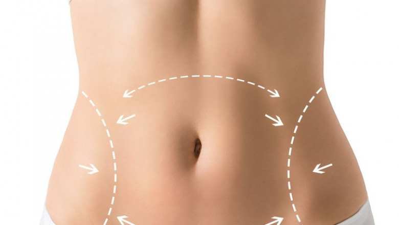 The Science Behind Fat Transfer in Dubai: Expert Advice from the Best Doctors