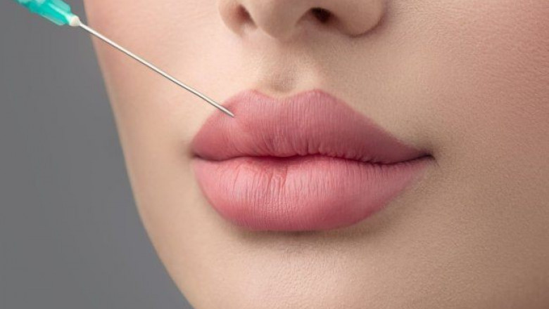 The Best Plastic Surgeon in Dubai Shares How Russian Lip Fillers Improve Lip Hydration