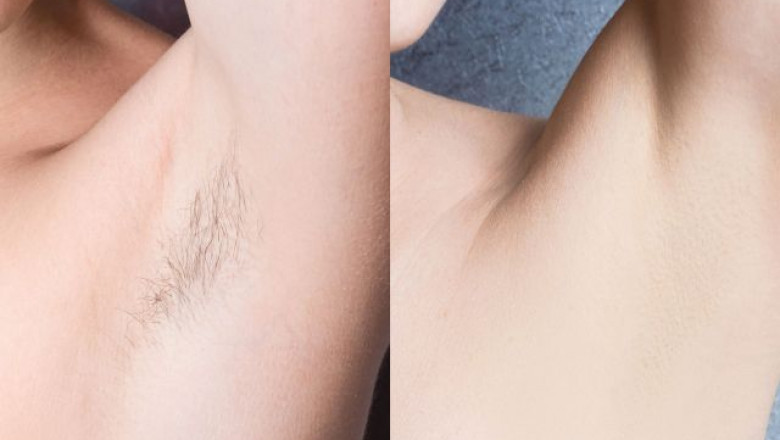 Smooth Skin Ahead: Cellulite Treatment and LED Light Therapy Options
