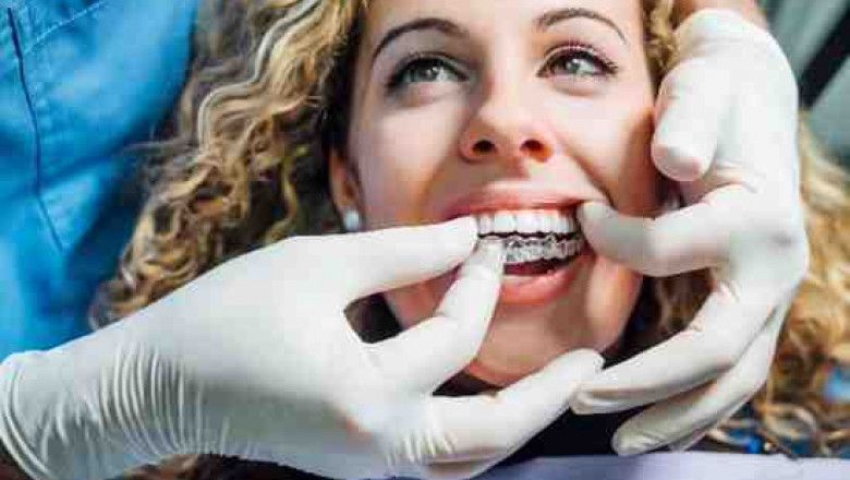 Personalised Support for Lasting Dental Wellness in Bicester