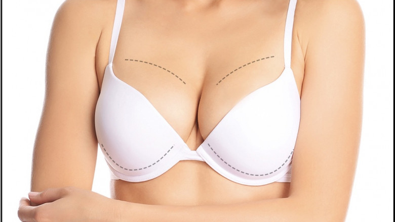 Breast Enlargement: How to Prepare for Your Breast Enlargement Procedure
