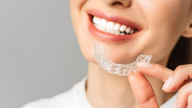 From Consultation to a Perfect Smile: How Taylor Dental and Braces Delivers Top Veneers in Texas