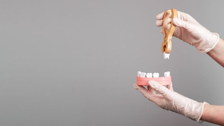 Need A Tooth Extraction in Grants? Here’s Why Sundance Dental Grants is the Best Choice