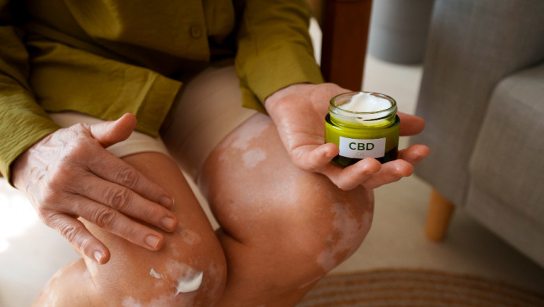 How to Cure Eczema Psoriasis permanently - A Quick Guide