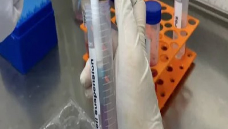 Unveiling the Potential of Adipose Derived Stem Cell Therapy in Regenerative Medicine