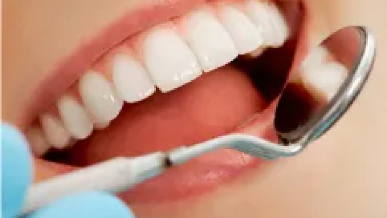 Boutique Teeth Whitening with DentalyGo: Your Path to a Radiant Smile