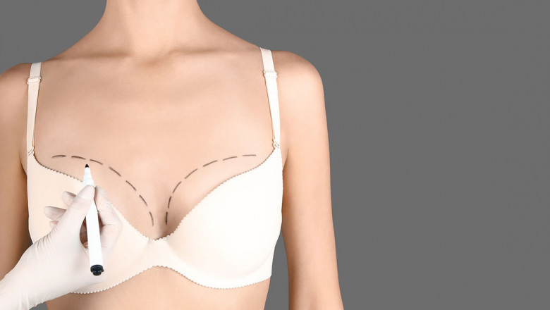 Breast Augmentation in Riyadh | Enhance Shape &amp; Confidence 2025