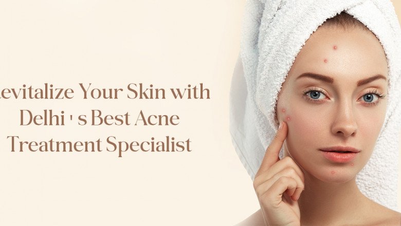 Chemical Peel Treatment in Delhi – Reveal Radiant, Younger-Looking Skin