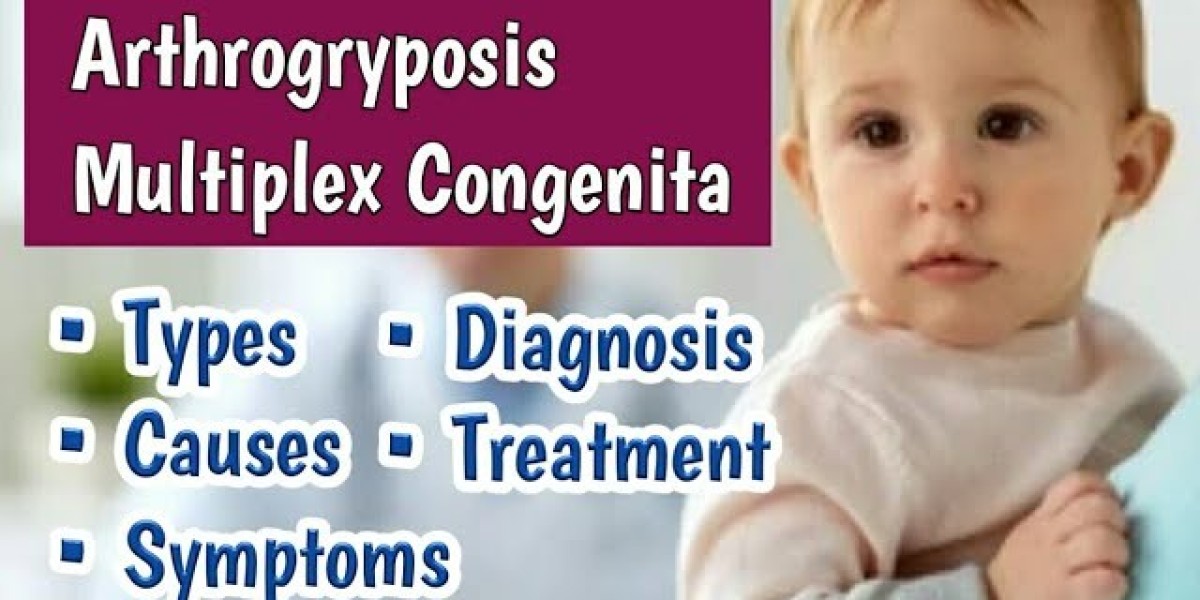 Arthrogryposis Management Market Report 2024: Key Insights and Industry Outlook