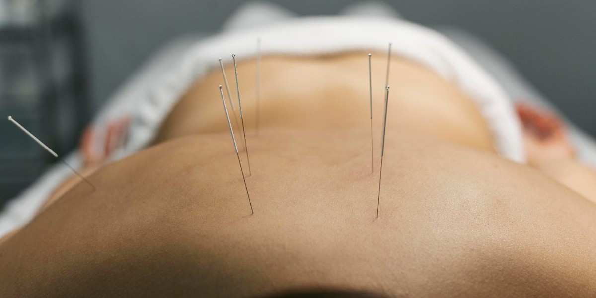 Discover the Power of Acupuncture and Biomagnetic Healing