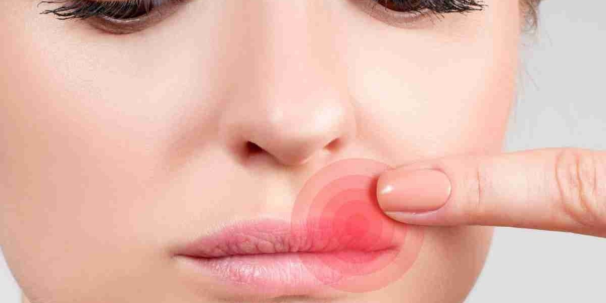 Cold Sore Treatment Market Primed for Growth Due to Advancements in Gene Therapies