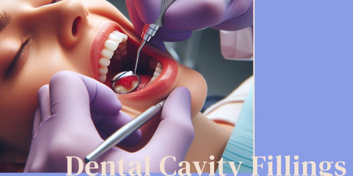 Comparing Tooth Filling Cost Without Insurance and Dental Implant Cost in NYC