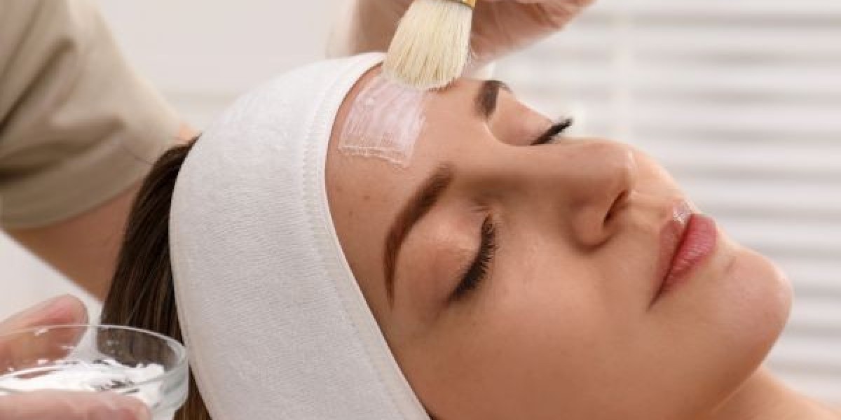 How to Incorporate Chemical Peels into Your Skincare Routine