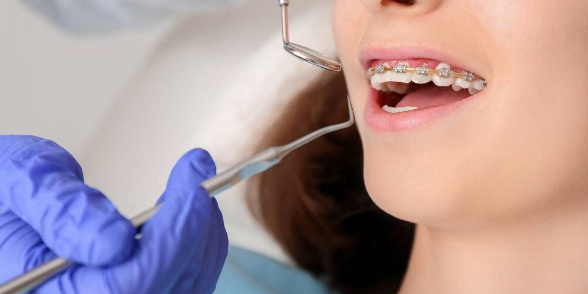 How to Choose the Right Dental Braces in Dubai?