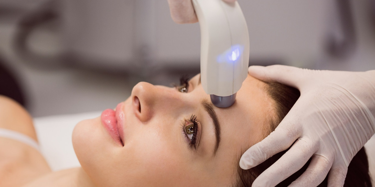 Beauty Starts with Escape Aesthetics: HIFU for Face Treatment Luton