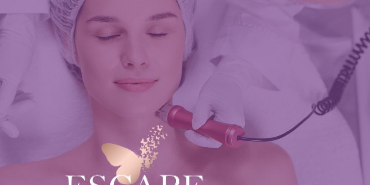 Escape Aesthetics Trusted Microneedling Treatment in Dunstable