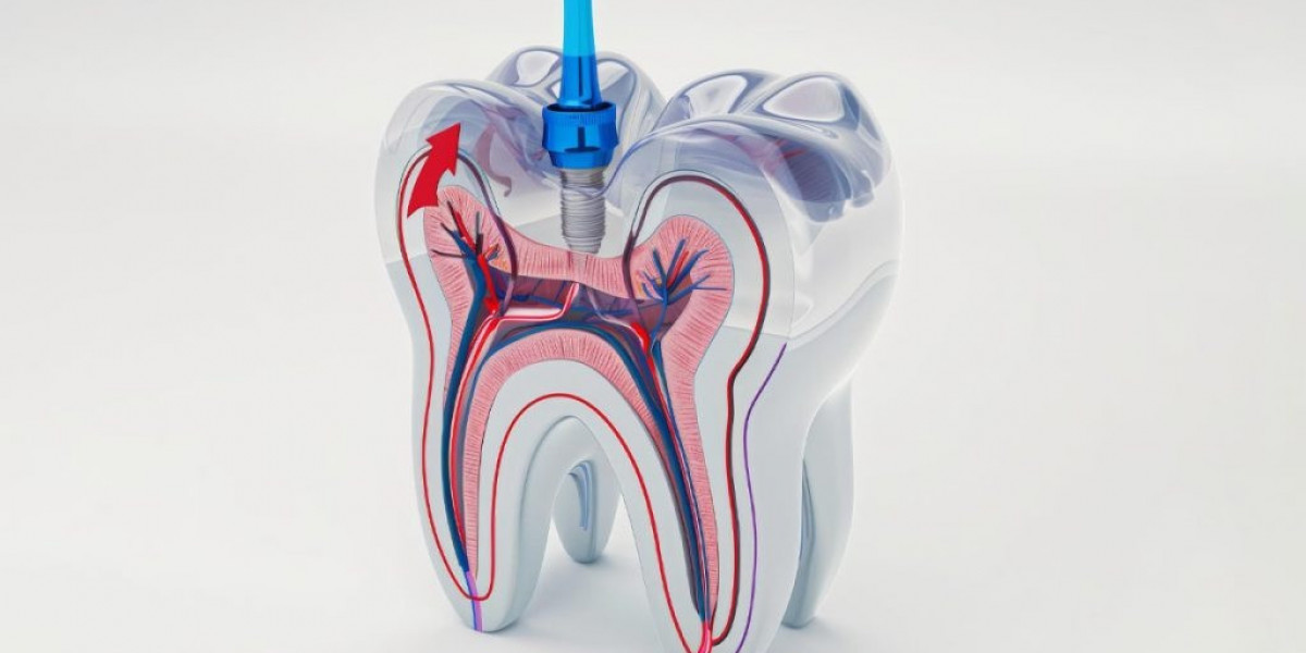 Understanding Root Canal Treatment: Symptoms, Procedures, and Emergency Care