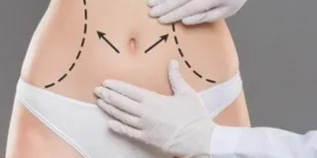 Male Tummy Tuck: A Growing Trend in Islamabad