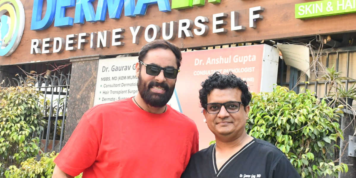 A Comprehensive Guide to Types of Hair Transplants in Delhi