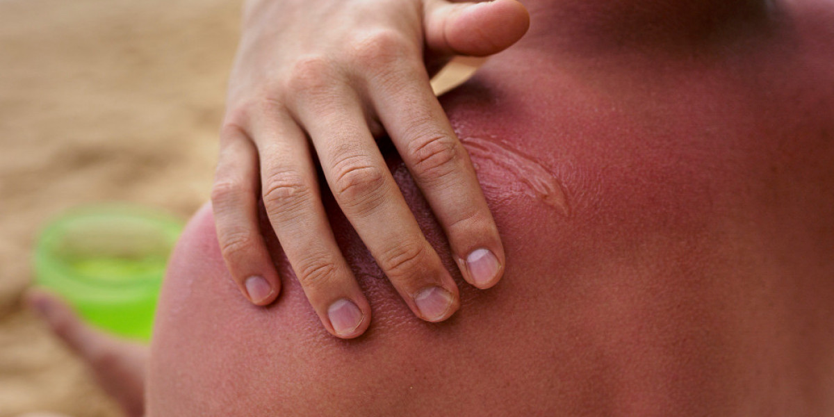Keloid Market Insights: Innovations and Strategic Outlook by DelveInsight