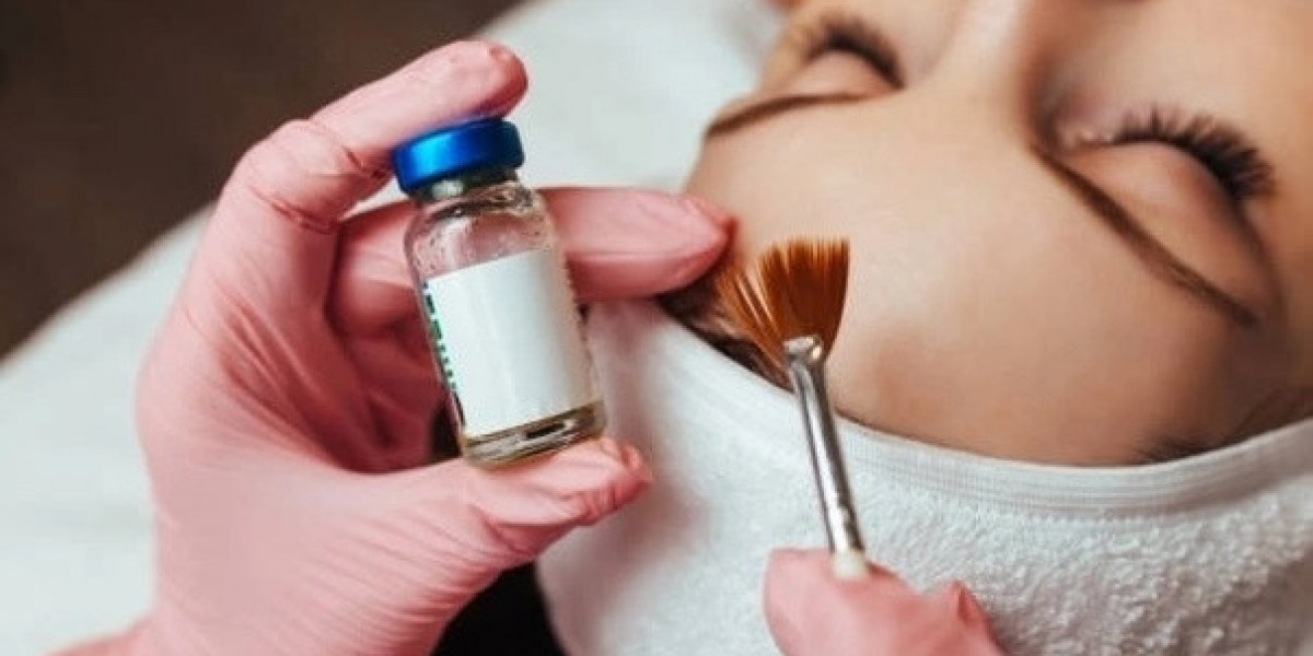 What to Expect During a Chemical Peel Session