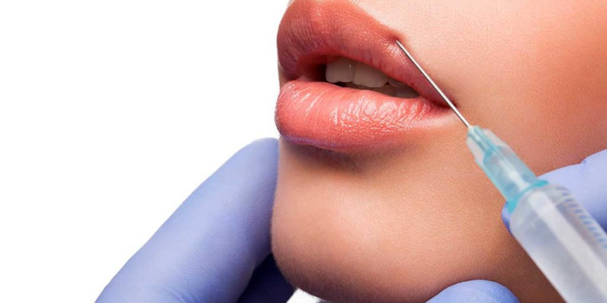 Before and After Lip Fillers: Real Results, Real Stories