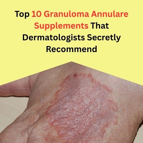 Top 10 Granuloma Annulare Supplements That Dermatologists Secretly Recommend - Post by Ellis