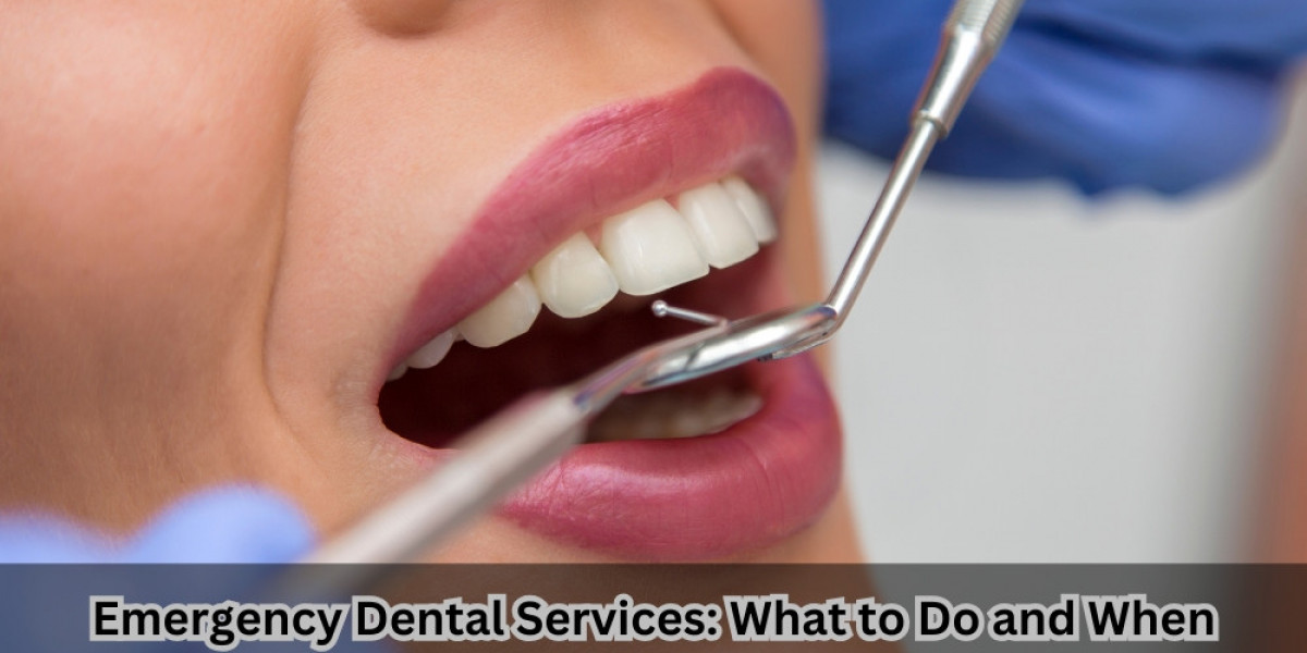 Emergency Dental Services: What to Do and When