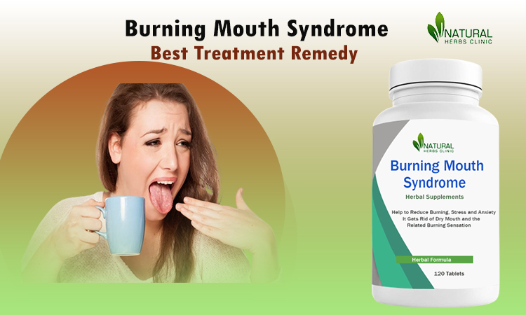Over the counter Treatment for Burning Mouth Syndrome