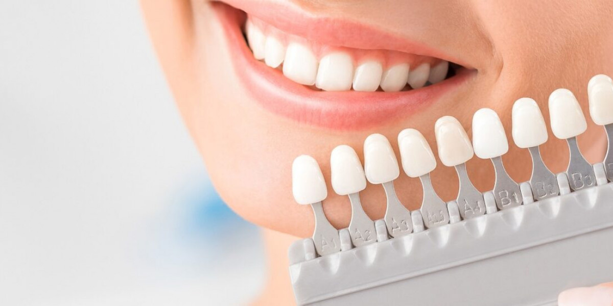 Teeth Whitening in Savannah