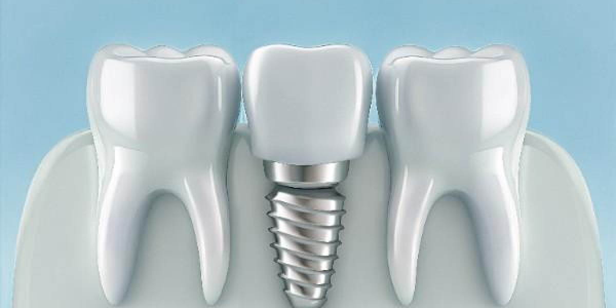 Achieve a Natural Smile with Fixed Restorations in Newcastle