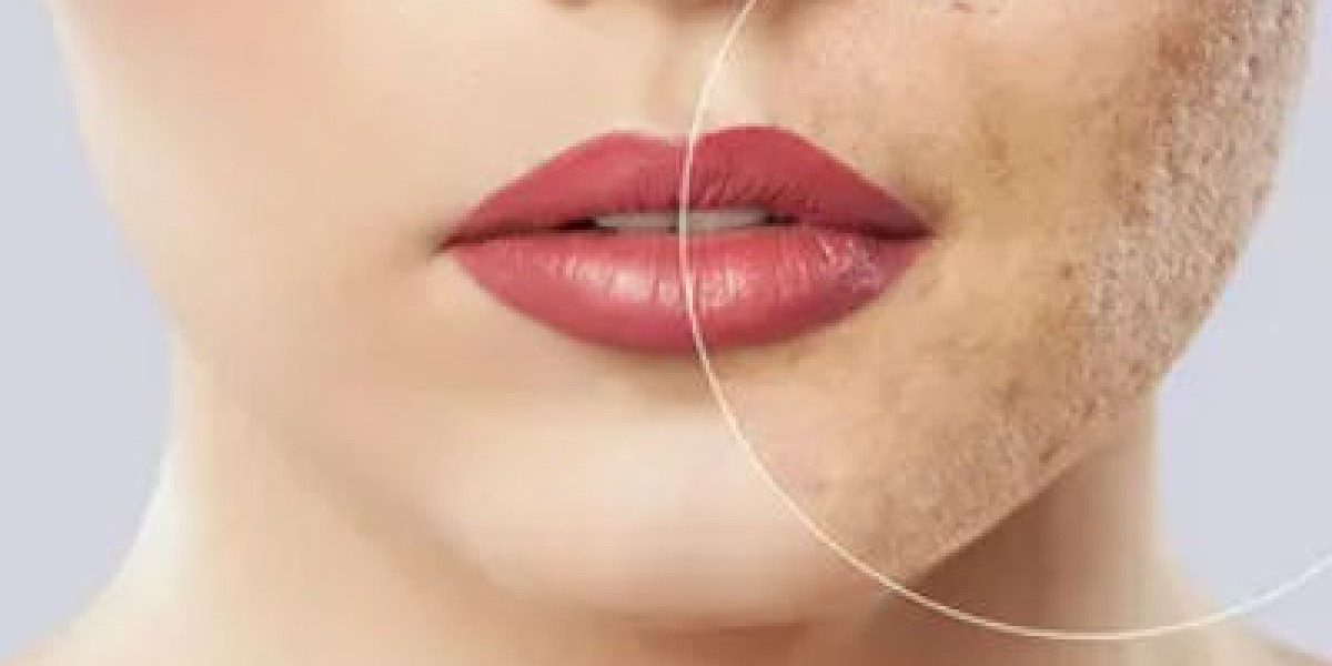 Is Acne Scar Treatment Safe for Sensitive Skin in Islamabad?