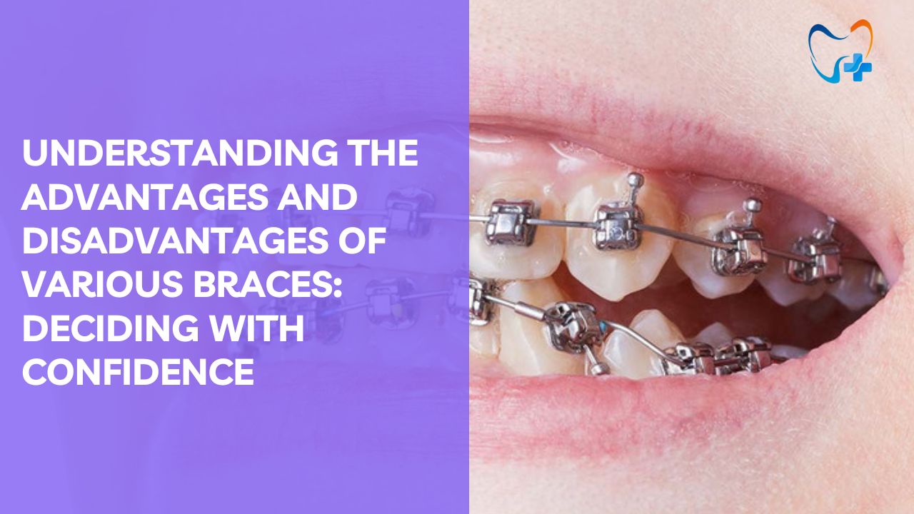 Understanding The Advantages And Disadvantages Of Various Braces Deciding With Confidence 